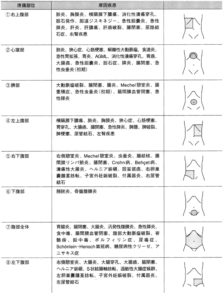 盲腸 診断 チェック