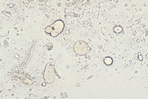 性腺分泌物