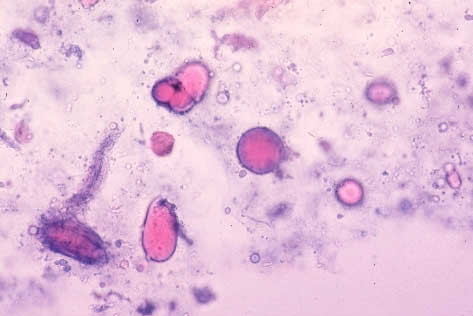性腺分泌物 (同一標本のステルンハイマー変法染色)