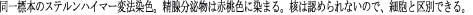 同一標本のステルンハイマー変法染色。精腺分泌物は赤桃色に染まる。核は認められないので、細胞と区別できる。